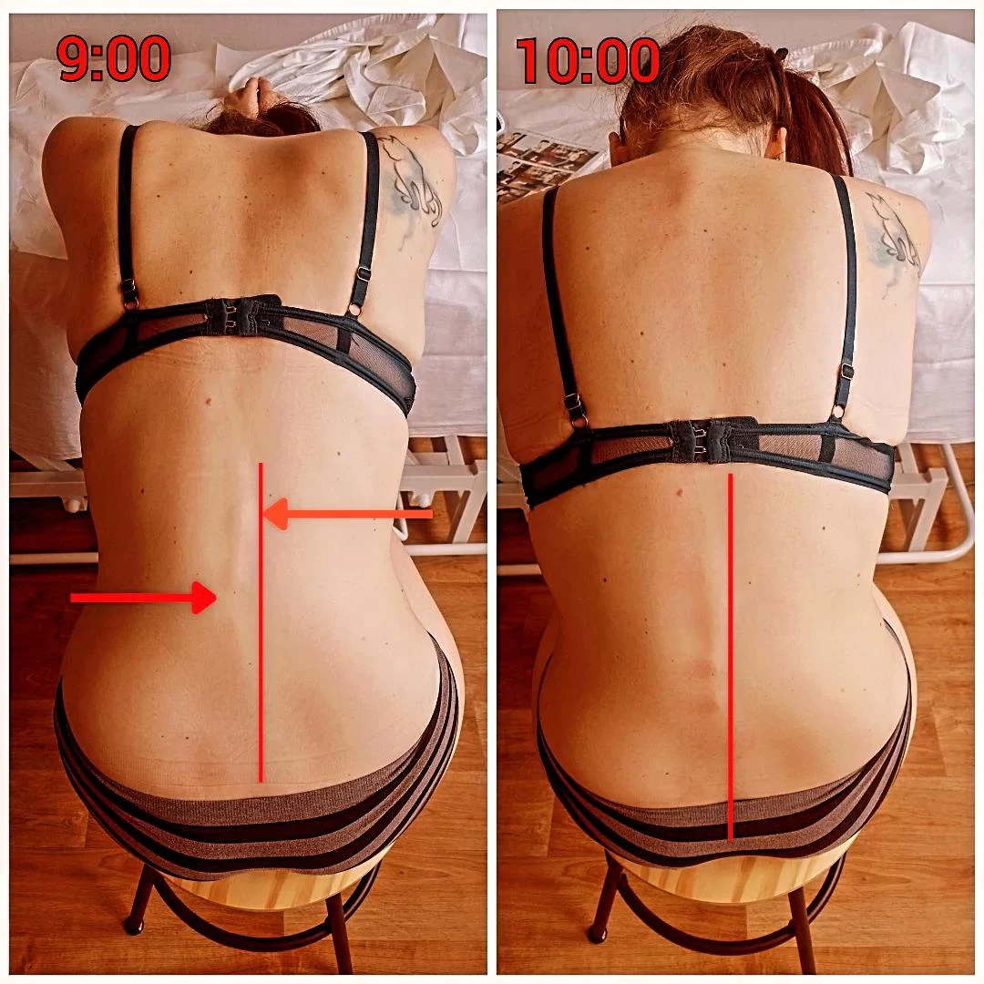 Masáže Dan - Dornova metoda Plus - obrázek 4